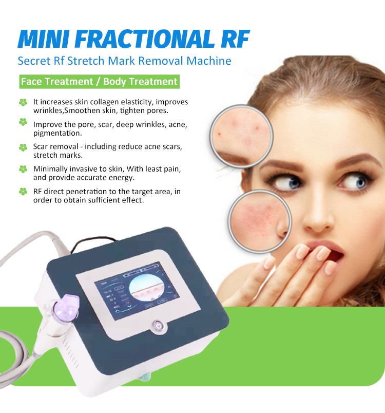 Mini fractional rf