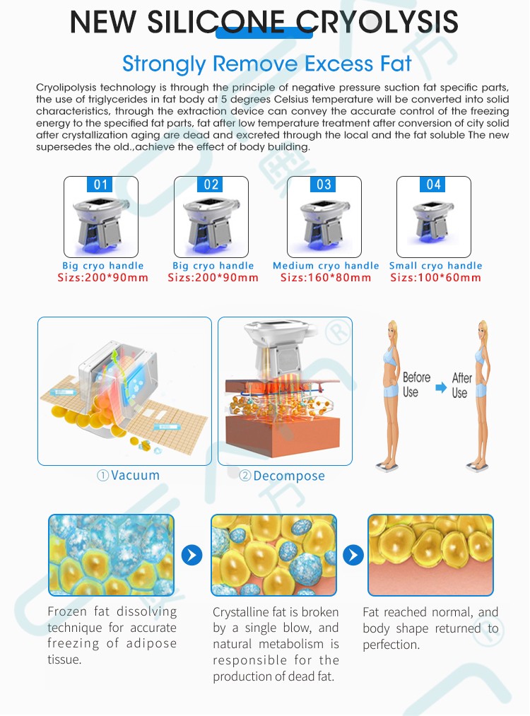 Portable Cryo