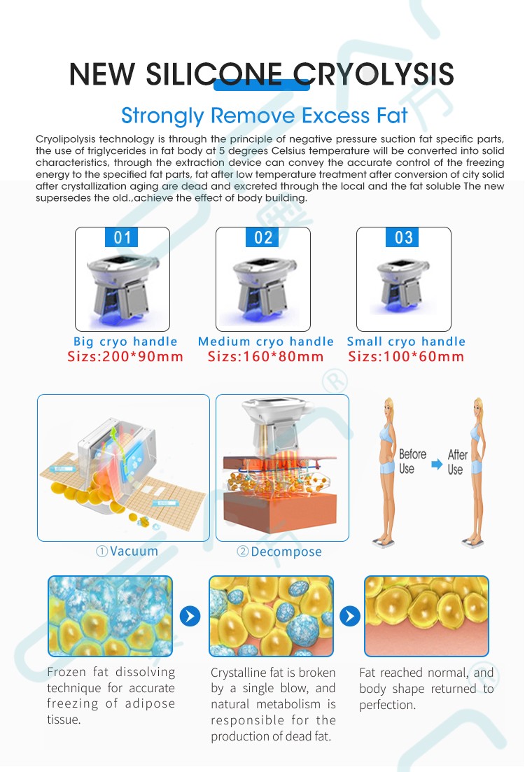 Cryo Fat Freezing Machine