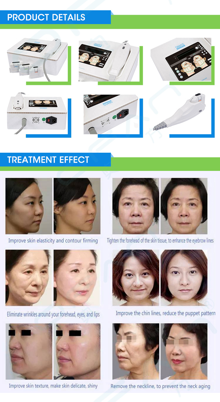 Mini HIFU Facial Machine