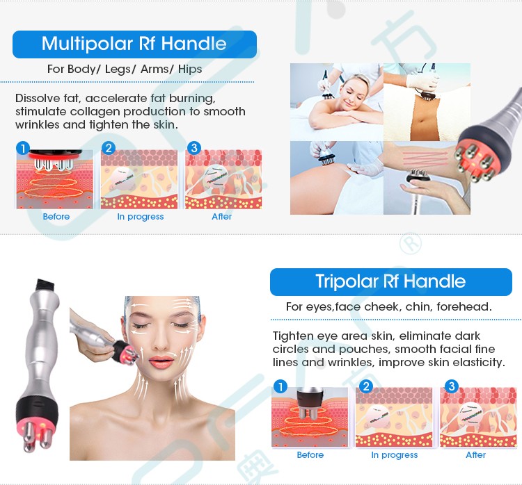 6 In One Cavitation Machine