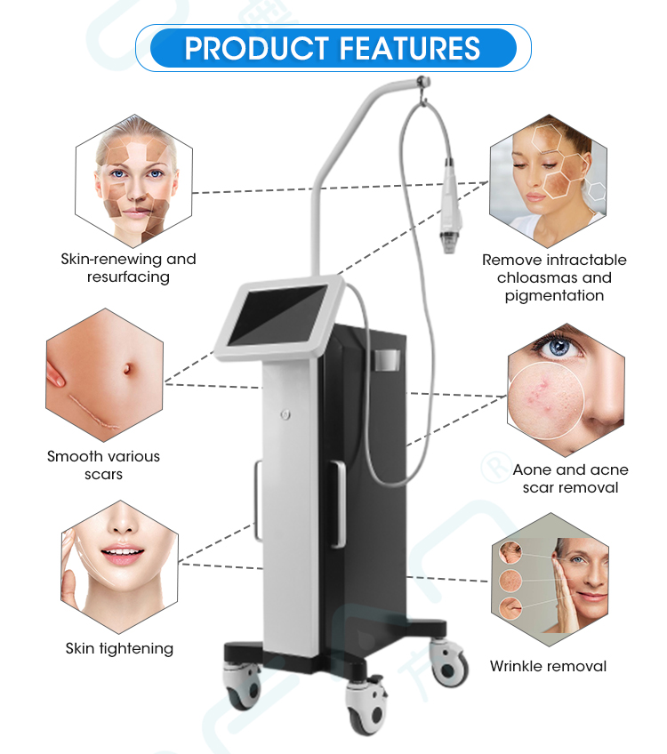 Stationary Fractional RF