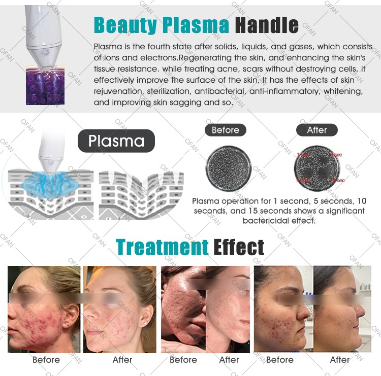 Portable 3IN1 Fractional Plasma Machine