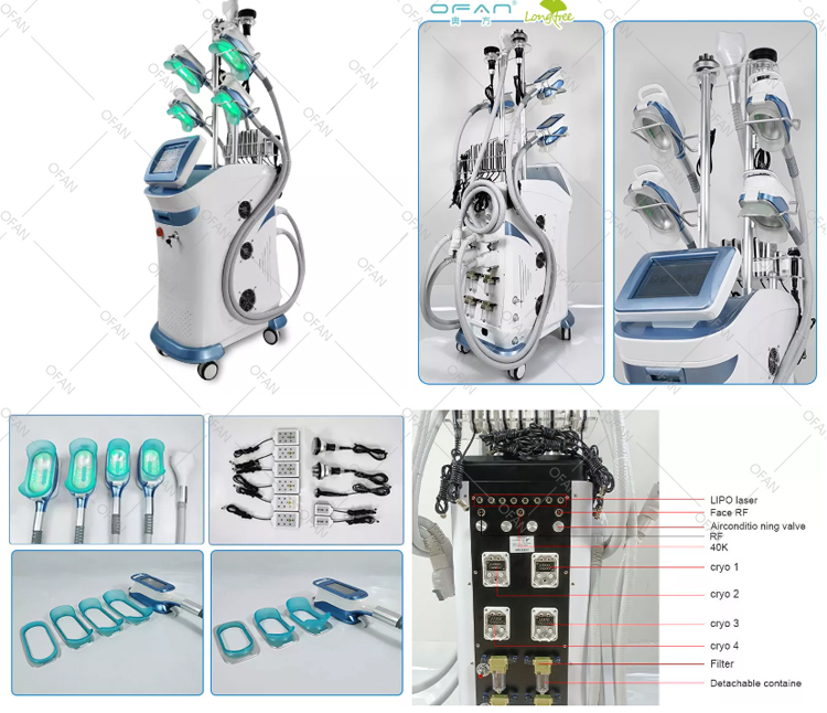 Cryolipolyse 360Cryo 5 handles