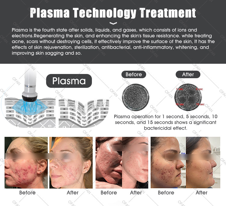 2in1 Plasma