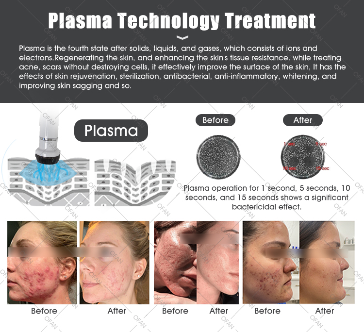 3in1 Plasma