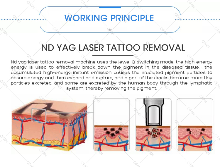 Best Selling 300W 500W Tattoo Pigment Melasma Speckle Removal Carbon Laser YAG Peel Skin Whitening Machine