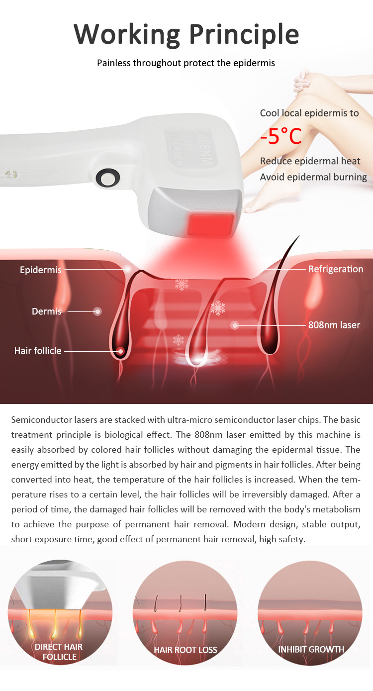 OFAN belleza laser beauty equipment 808/755/1064nm diode laser hair removal