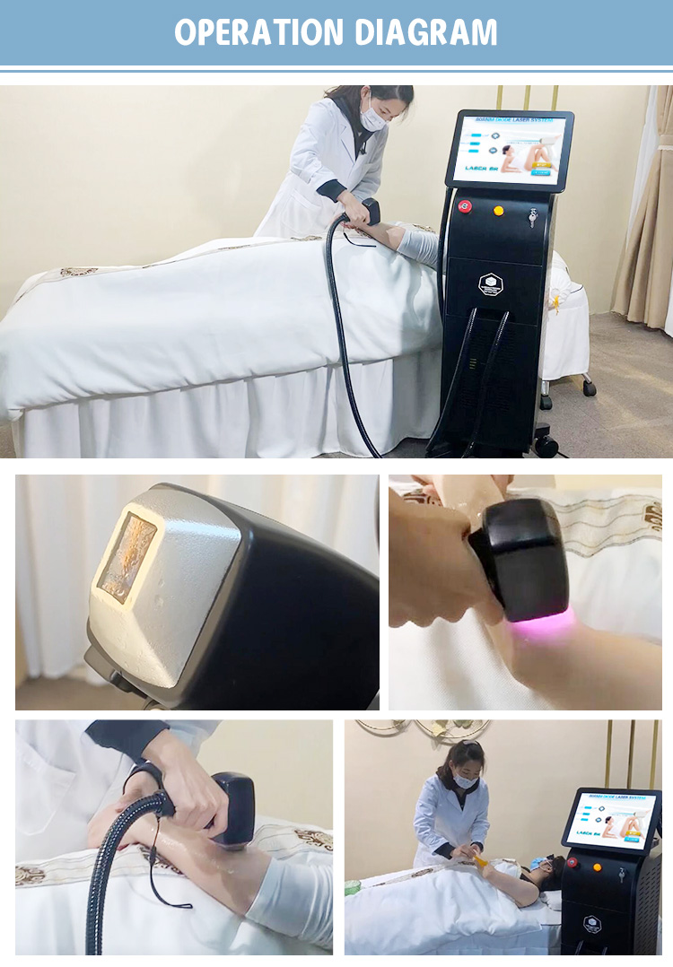 Ofan 1064 808 755 Diode Laser Hair Removal Machine Rano Titanium Ice Laser Diodo Hair Removal Machine soprano Titanium Ice Laser