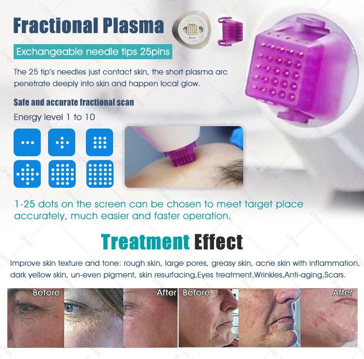 Portable 3IN1 Fractional Plasma Machine