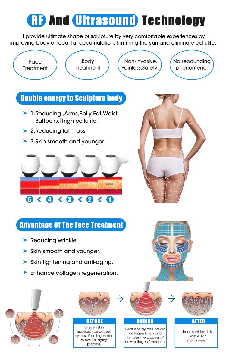 OFAN Radio Frequency Exilift ultra 360 RF Skin Tightening Machine