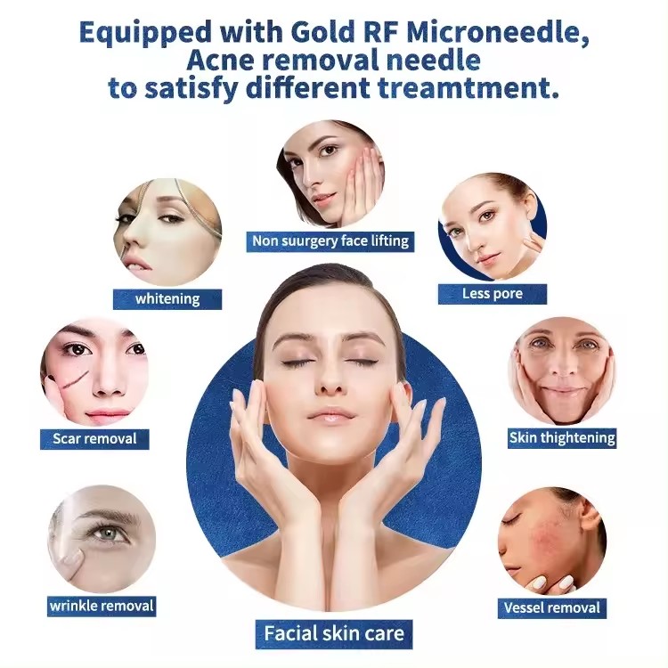 OFAN RF Fractional Microneedling Machine