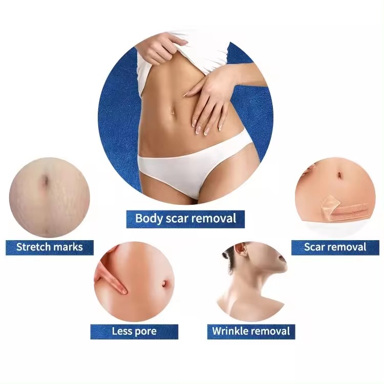 OFAN RF Fractional Microneedling Machine
