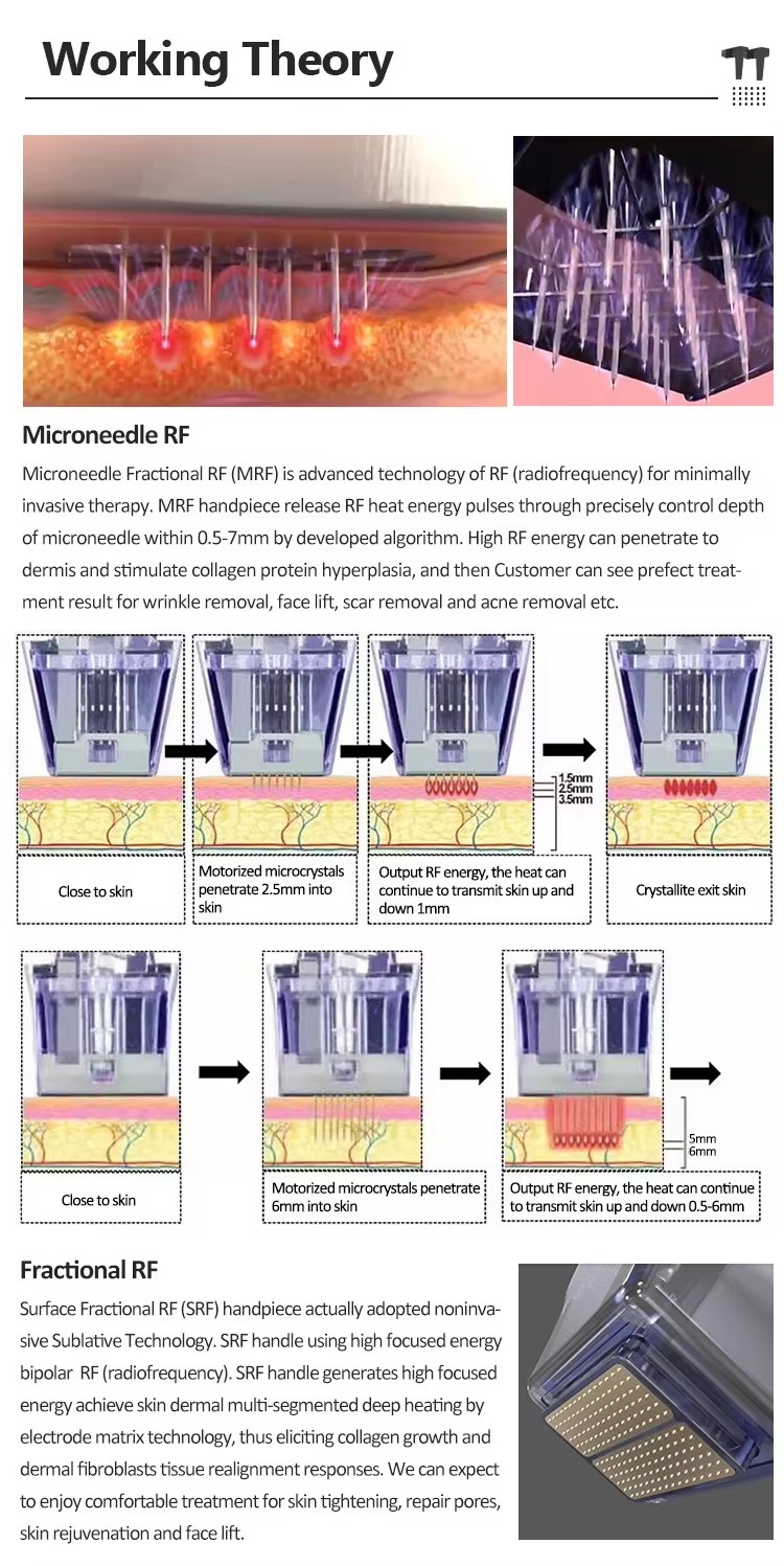 OFAN RF Microneedle 12pin 24pin 40pin Needle RF Fractional Microneedling Machine