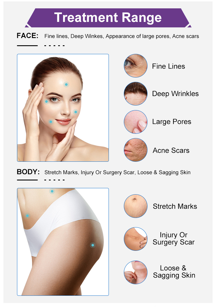 OFAN RF Fractional Microneedling Machine