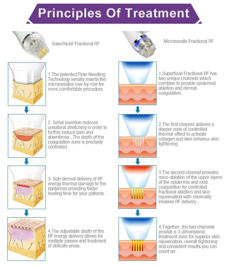 OFAN RF Fractional Microneedling Machine